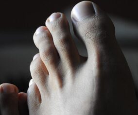 Fußhygiene